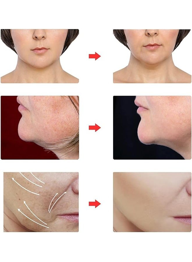 إسكدنيا الشكل V القابل لإعادة الاستخدام حمالة رفع الوجه، وجه جميل النحت قناع النوم، تخفيف ترهل الجلد، تقليل الحراك والجلد الثابت، حزام رفع الوجه للرجال والنساء -وردي - Image 3