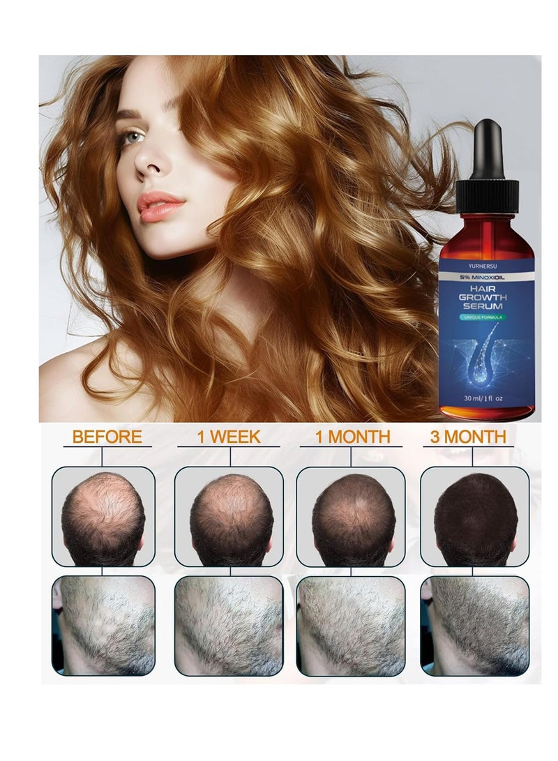 YURHERSU Hair Growth Serum, 5% Minoxidil, With Biotin & Glycerin, for Men's Beard & Women's Hair Regrowth, Anti Hair Loss Treatment, Make Hair Stronger Thicker Longer, 1 fl oz (30 ml) - Image 3