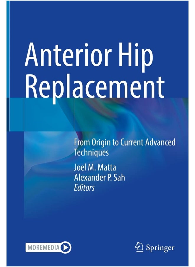 Anterior Hip Replacement: From Origin to Current Advanced Techniques 