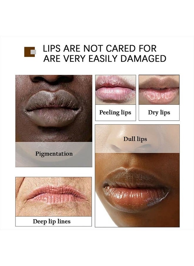 Yoxier - Lips Pink Fresh Fast Lightening Bleaching Cream Balm Treatment Remove Dark Lips, 0.7 Fl Oz (Pack of 1) - Image 1