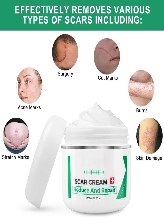 find back Scar Cream for Surgical Scars, Acne Scar Treatment, Scar Gel for Old Scars & New Scars, Face, Scar Away, Reduces Scars Appearance, Scar Removal Cream, 1.7 Fl.Oz - Image 3