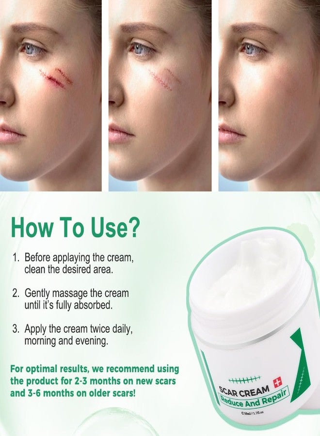 find back Scar Cream for Surgical Scars, Acne Scar Treatment, Scar Gel for Old Scars & New Scars, Face, Scar Away, Reduces Scars Appearance, Scar Removal Cream, 1.7 Fl.Oz - Image 4