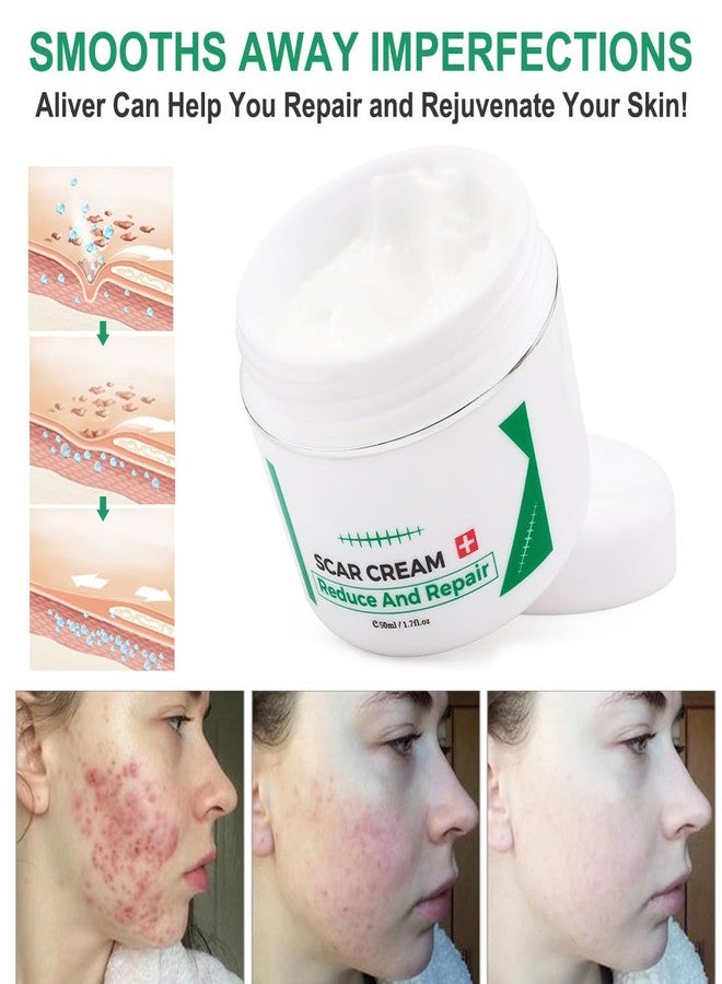 find back Scar Cream for Surgical Scars, Acne Scar Treatment, Scar Gel for Old Scars & New Scars, Face, Scar Away, Reduces Scars Appearance, Scar Removal Cream, 1.7 Fl.Oz - Image 5