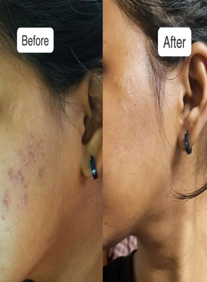 vilvah STORE سيروم فيلوف ستور لتفتيح البشرة مع مستخلص حليب الأرز، مستخلص الطحالب البحرية، ألفا أربوتين، يقلل الندبات، يضيء البشرة ويوحد لونها لجميع أنواع البشرة، 20 مل - Image 4