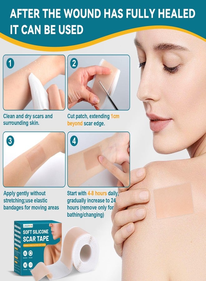 LINSIRON Silicone Scar Tape,Silicone Scar Sheets 1.6"X60" Roll,Reusable Medical Grade Scar Away Silicone Scar Sheets and Face Tape for Wrinkles, Keloid Scars, Hypertrophic Scars - Image 3
