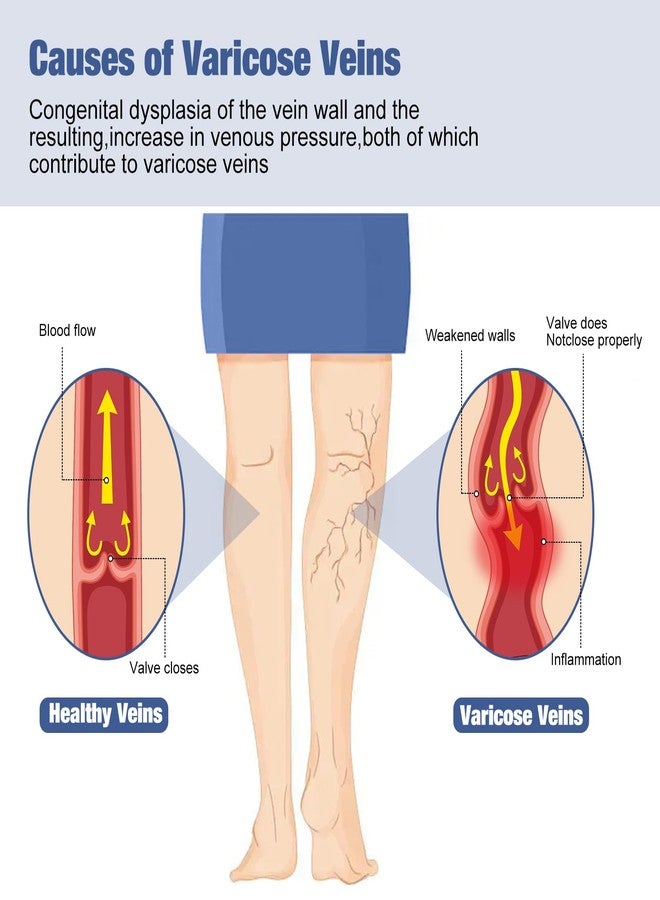 fangtaiabc 36PCS Varicose Veins Patch-Professional Relief for Varicose Veins in The Legs-Natural Improvement Spider Veins Patch- Strengthen Capillary Health and Improve Blood Circulation - Image 4