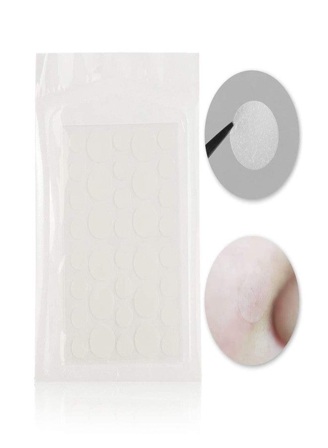 Mantavya Acne Pimple Patches for Face (72 Acne Patches for Pimples)| Waterproof Pimple Acen Patch Kit | Complete Pimple Remover and Acne Patch Set | For All Skin Types (Pack Of 2) - Image 3