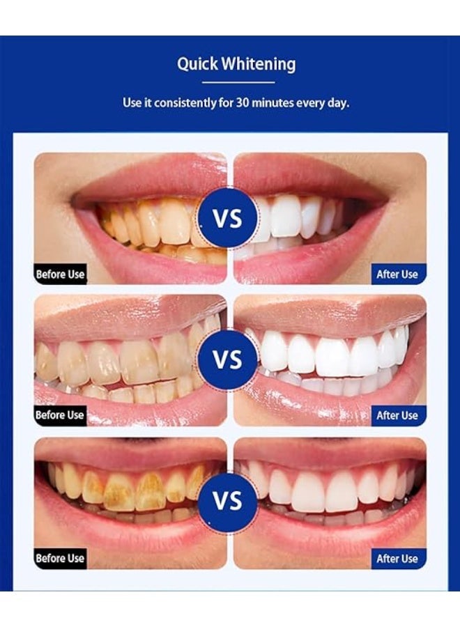 9D Teeth Whitening Strips-14 Strips - Image 3