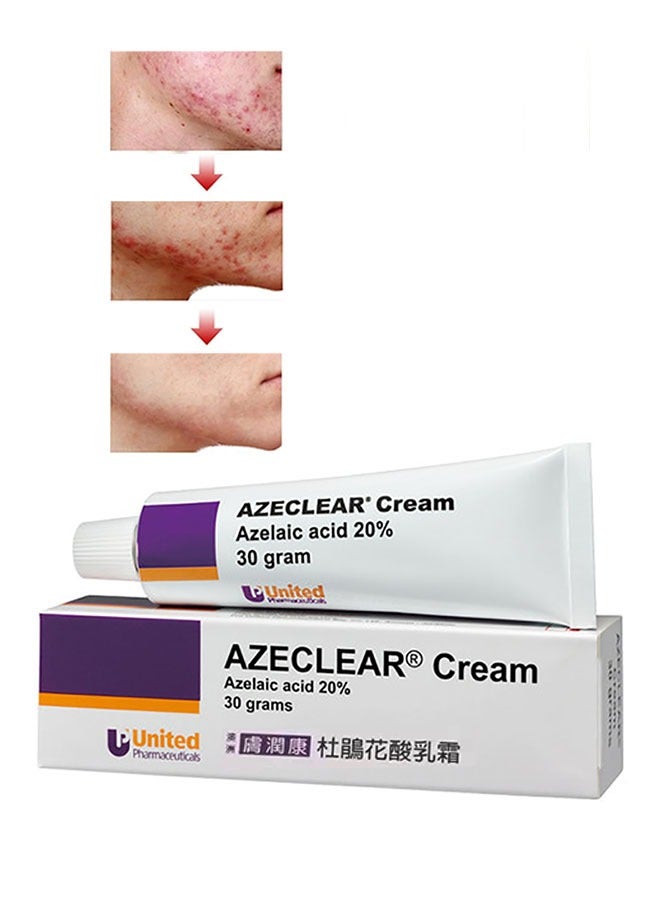 United Azeclear Cream 30g, Acne Removing Gel, Oil Control and Repair Blackhead Closing Face Cream