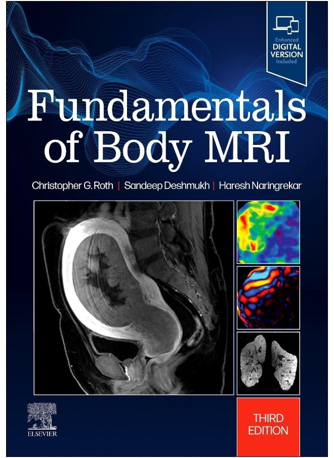 null - Fundamentals of Body MRI - Image 1