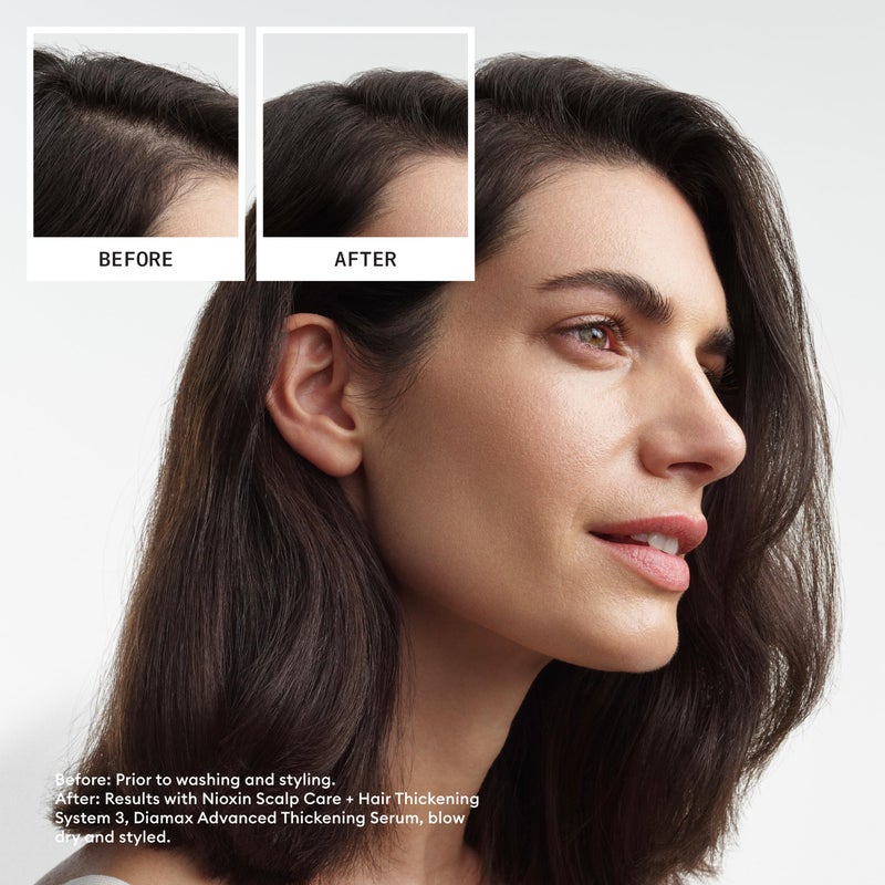 Nioxin System 3 Scalp + Hair Thickening Treatment | Serum for Colored or Damaged Hair with Light Thinning | 3.4 Fl oz. - Image 2
