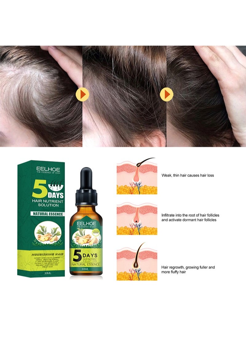 EELHOE - 2 Pieces Of Hair Nutrient Solution，Natural Ginger Essence, Stimulates Hair Growth, Slows Down Hair Loss, And Restores Hair Luster - Image 1