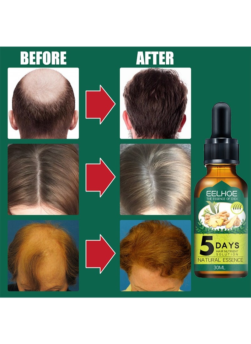 EELHOE - 2 Pieces Of Hair Nutrient Solution，Natural Ginger Essence, Stimulates Hair Growth, Slows Down Hair Loss, And Restores Hair Luster - Image 1