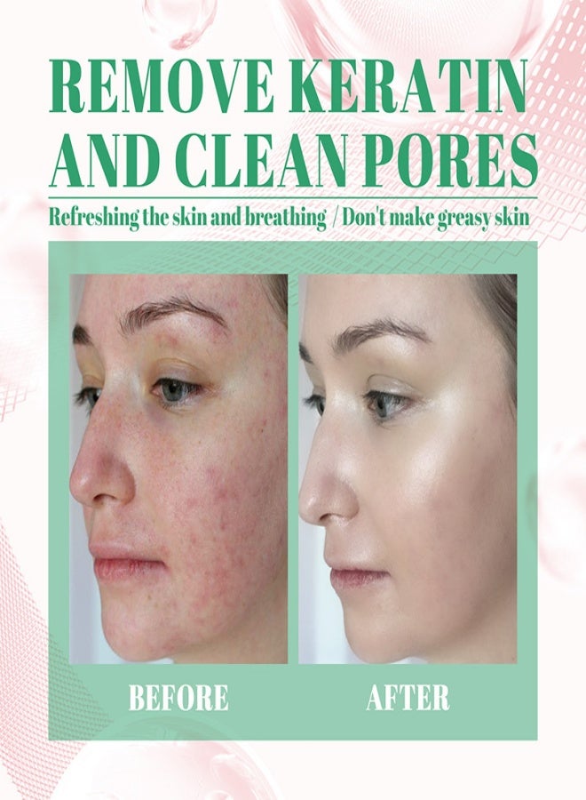 Der.J Tea Tree Cleansing Mask - Image 3