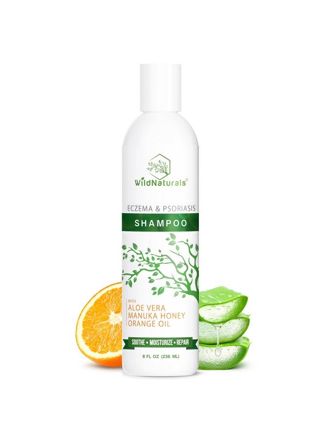 وايلد ناتشورلز شامبو الصدفية للعناية بفروة الرأس الجافة - مضاد للقشرة - شامبو مرطب لطيف لعلاج حكة فروة الرأس - Image 1