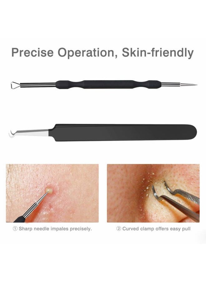 JPNK - Blackhead Remover Tool Comedones Extractor Acne Removal Kit for Blemish, Whitehead Popping, 6 Pcs Zit Removing for Nose Face Tools with a Leather Bag (Black) - Image 1