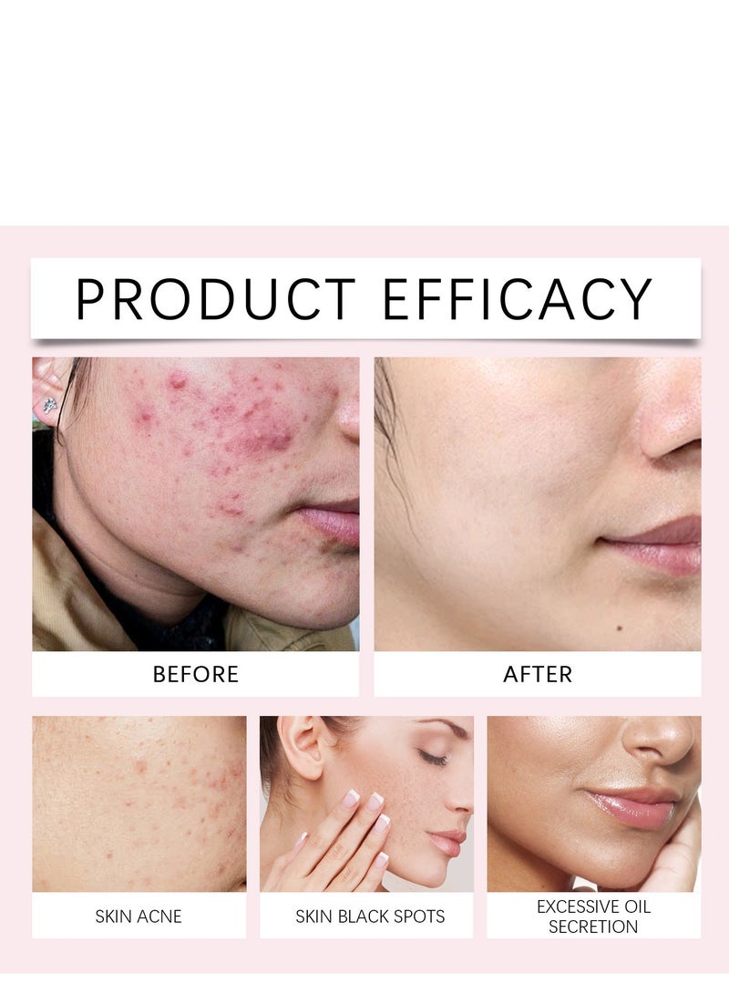 إيلهو أقراص تنظيف حمض الكوجيك والكركم، للوجه والجسم، تزيل الكيراتين الزائد، تقلل البقع السوداء وتنظف البشرة، 40 قطعة - Image 3