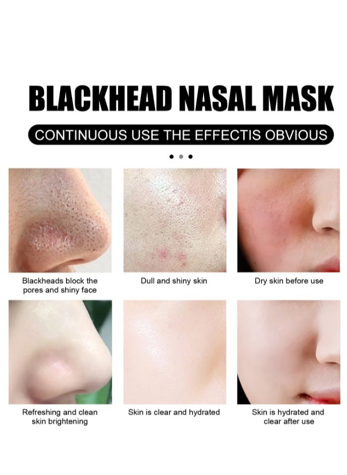 EELHOE Nose Pore Strips Gentle In Blackhead Remover Mask Wrinkle & Dark Circles Facial Pore Cleanser Purifying Face Mask Nose Strips 30G  - Image 2