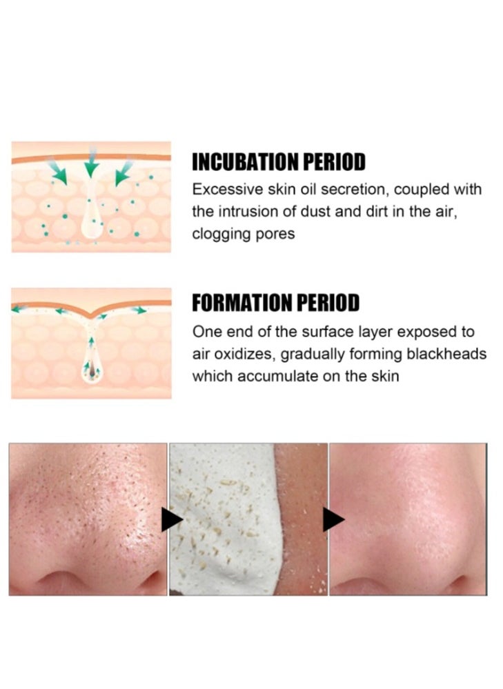 EELHOE Nose Pore Strips Gentle In Blackhead Remover Mask Wrinkle & Dark Circles Facial Pore Cleanser Purifying Face Mask Nose Strips 30G  - Image 3