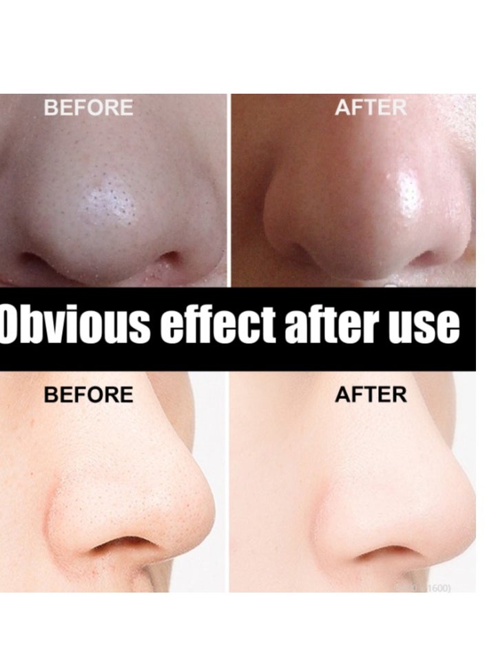 EELHOE Nose Pore Strips Gentle In Blackhead Remover Mask Wrinkle & Dark Circles Facial Pore Cleanser Purifying Face Mask Nose Strips 30G  - Image 4