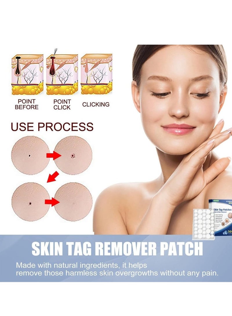 إيلهو 144PCS Wart Removal Patches, Natural Wart Remover Plasters, Mole and Skin Tag Removal Pads, Pain-Free Wart Treatment for Hands, Face, and Body - Image 5