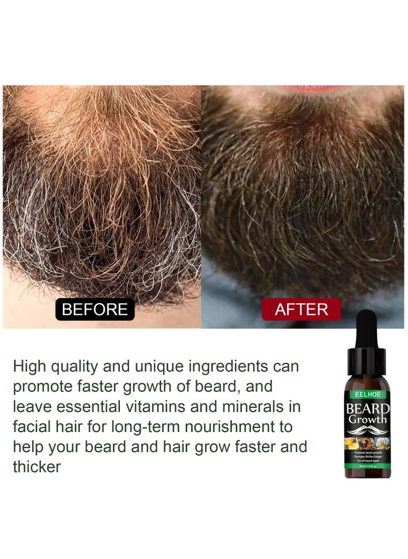 EELHOE - NEW Beard Hair Growth Essential Oil Anti Hair Loss Product Natural Mustache Regrowth Oil for Men Nourishing Beard Care Roller - Image 1
