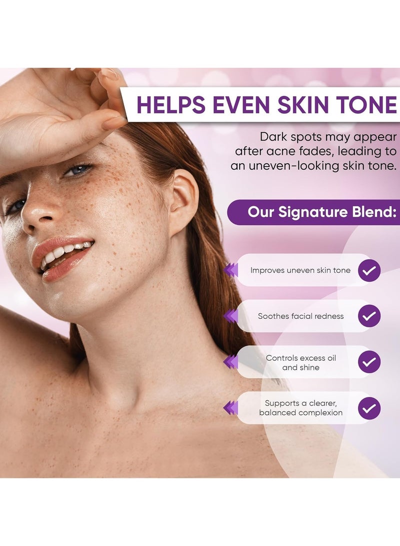 OUHOE 14% Azelaic Acid Acne Cream, Advanced Azelaic Acid Serum, Redness Relief for Face, Redness Reducing Skin Care, Prevents Acne Breakouts, Ease Pimple Clarify Skin Soothe Irritation - Image 2
