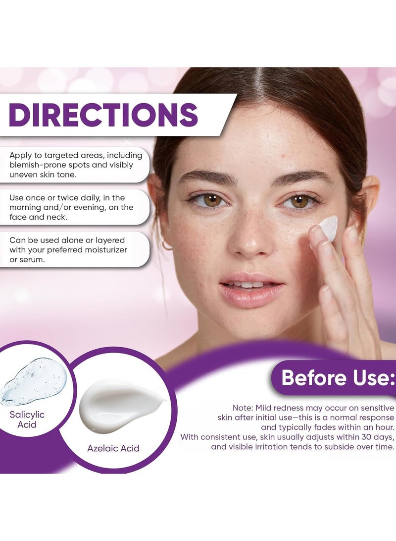 OUHOE 14% Azelaic Acid Acne Cream, Advanced Azelaic Acid Serum, Redness Relief for Face, Redness Reducing Skin Care, Prevents Acne Breakouts, Ease Pimple Clarify Skin Soothe Irritation - Image 4