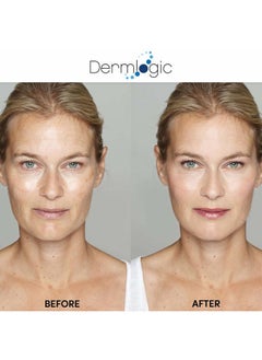 Dermlogic Anti Aging Resurfacing Peel Pads - Contains Salicylic, Glycolic, & Lactic for Face & Body. Includes Hyaluronic, & Witch Hazel, Green Tea & Aloe Vera. Exfoliates to Correct Dark Spots & Scars.  - Image 3