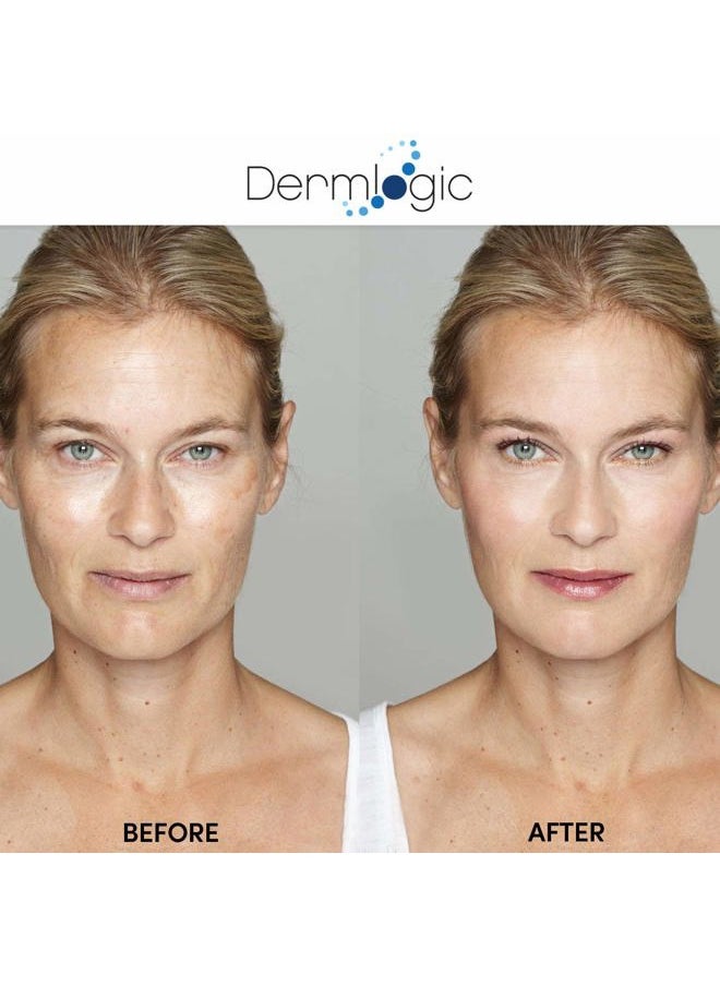 Dermlogic Anti Aging Resurfacing Peel Pads - Contains Salicylic, Glycolic, & Lactic for Face & Body. Includes Hyaluronic, & Witch Hazel, Green Tea & Aloe Vera. Exfoliates to Correct Dark Spots & Scars.  - Image 3