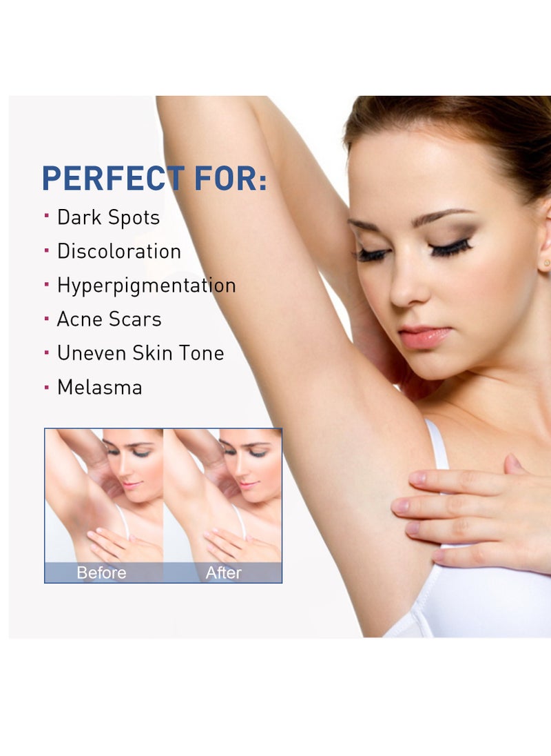 Excefore - Skin Lightening Cream Serum Skin Bleaching Cream Whitening Cream For Body Intimate Area, Private Parts, Underarm, Knees, Elbows, Inner Thigh, Bikini Areas, Bikini Line - Image 1