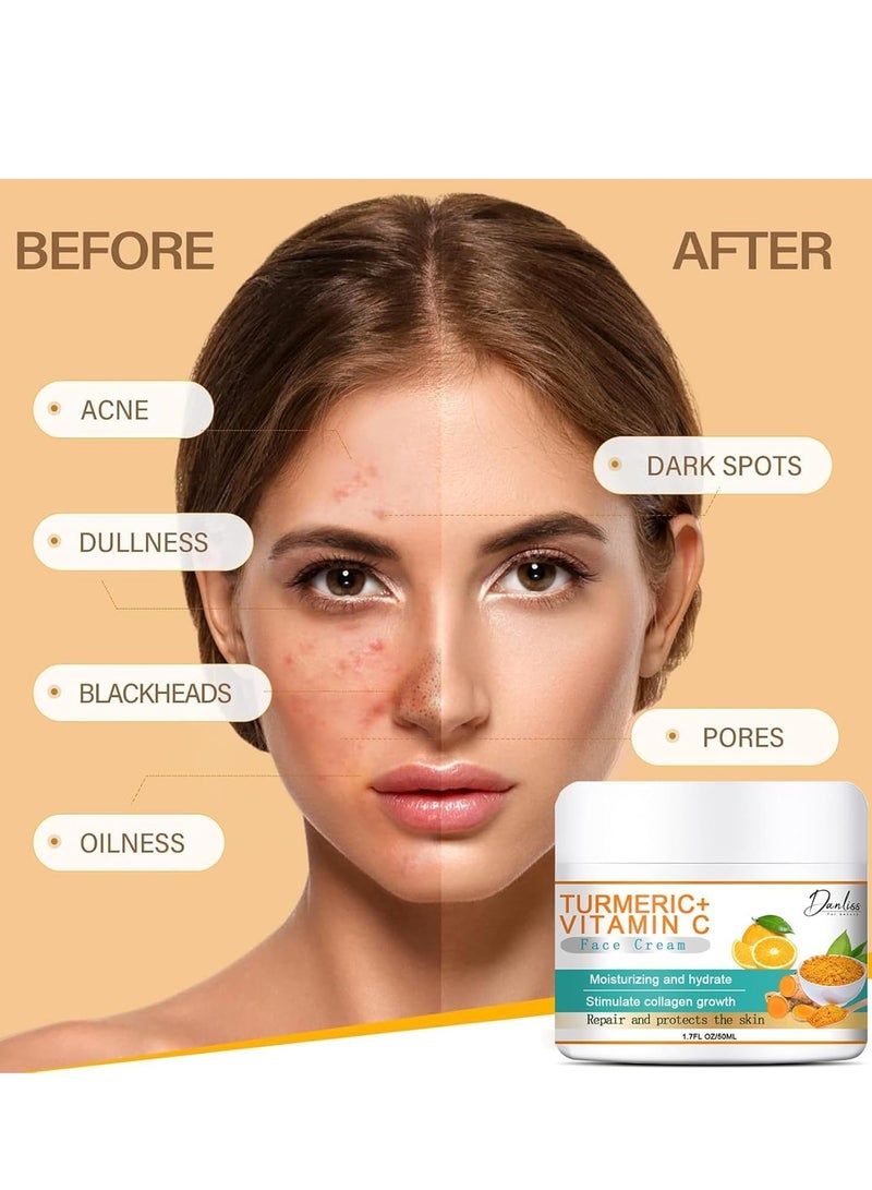 danliss Turmeric Dark Spot Cream, Natural Turmeric Skin Lightening Lotion, Anti-Aging Cream, Face Moisturizer, Vitamin C Cream, Face Dark Spot Repair Remover, Wrinkle Removal, Firming 50ml - Image 5
