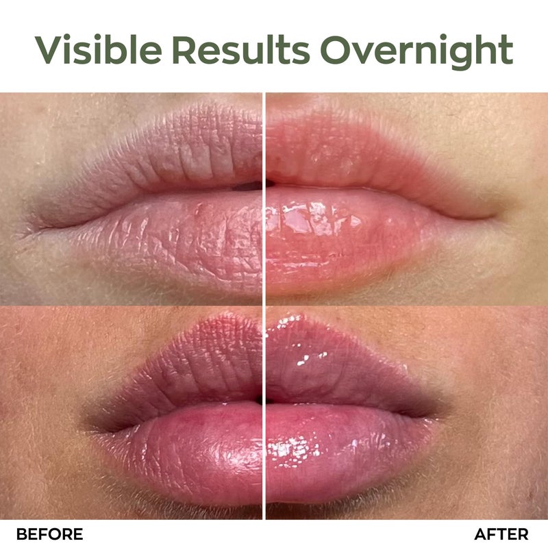 Elizabeth Mott Lip Sleeping Mask â€“ Overnight Treatment with Peptides to Repair, Hydrate & Restore Dry, Chapped, Cracked, Peeling Lips â€“ Moisturizing Collagen Balm to Soften, Smooth, Plump 0.71 oz - Image 3