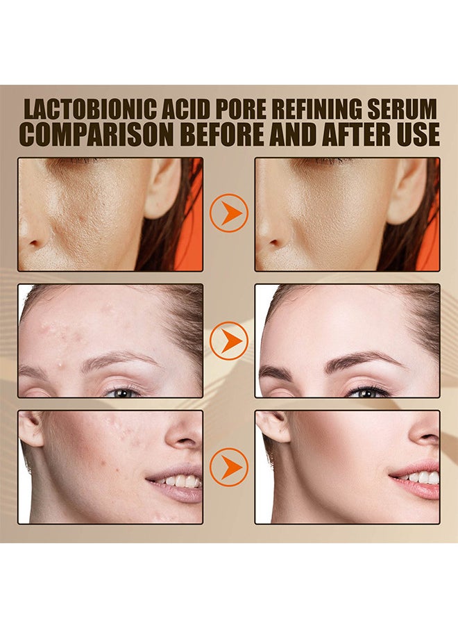 EELHOE - Lactobionic Acid Pore Refining Serum, Lactobionic Acid, Pores Tightening Serum, Vegan Pore Minimizer For Men And Women Regardless Of Age, 30ML - Image 1