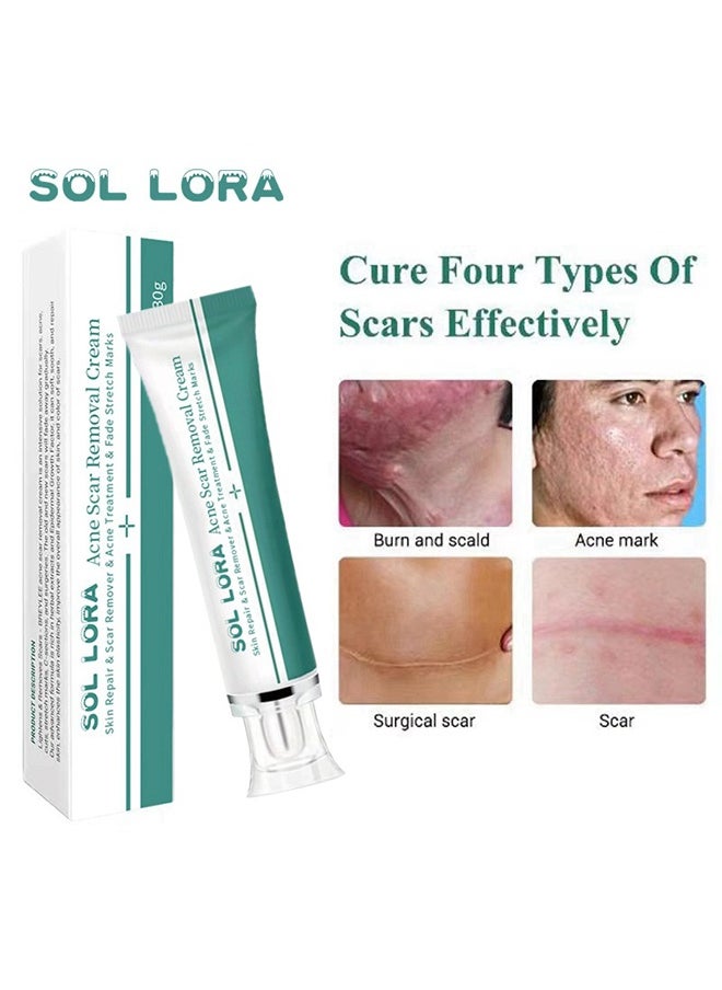 SOL LORA Acne Scar Removal Cream，Scar Erase ，Scar Removal Gel，Acne Scar Treatment，Deep Acne Scar Removal， Burns Keloids Hypertrophic， Repair Damaged Skin，Removing Acne Marks Scar Repair Cream ﻿30g  - Image 1