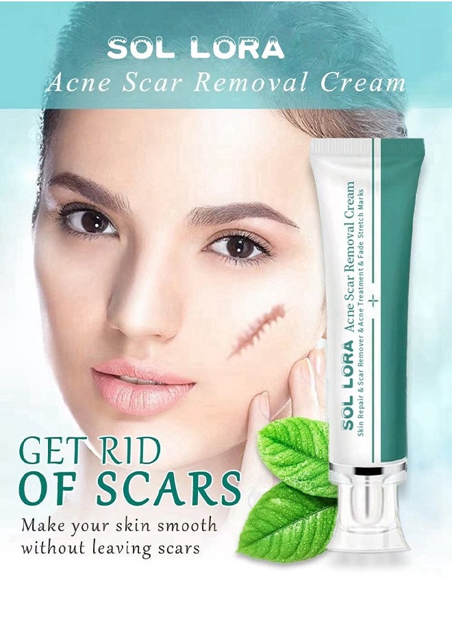 SOL LORA Acne Scar Removal Cream，Scar Erase ，Scar Removal Gel，Acne Scar Treatment，Deep Acne Scar Removal， Burns Keloids Hypertrophic， Repair Damaged Skin，Removing Acne Marks Scar Repair Cream ﻿30g  - Image 2