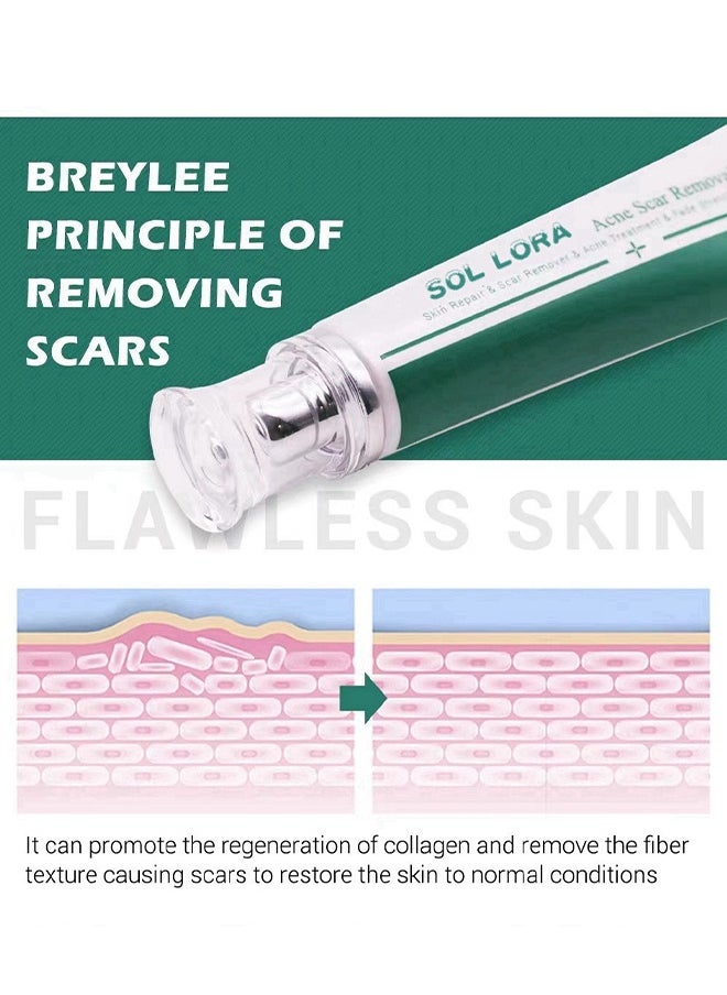 SOL LORA Acne Scar Removal Cream，Scar Erase ，Scar Removal Gel，Acne Scar Treatment，Deep Acne Scar Removal， Burns Keloids Hypertrophic， Repair Damaged Skin，Removing Acne Marks Scar Repair Cream ﻿30g  - Image 5