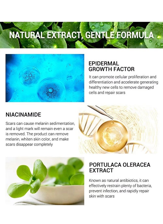 SOL LORA Acne Scar Removal Cream，Scar Erase ，Scar Removal Gel，Acne Scar Treatment，Deep Acne Scar Removal， Burns Keloids Hypertrophic， Repair Damaged Skin，Removing Acne Marks Scar Repair Cream ﻿30g  - Image 4
