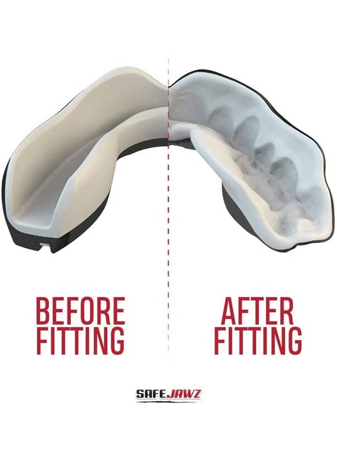 واي جيه حماية الفم بتصميم رفيع، مع واقي لثّة للبالغين والشباب مع علبة لممارسة الملاكمة، الرجبي، فنون القتال، الجودو، الكاراتيه، الهوكي وجميع الألعاب الرياضية القتالية. - Image 3