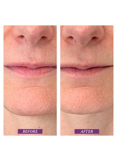 PRAI Beauty Ageless Lip And Line Filler For Instantly Ageless Lips | Lip Serum That Plumps Smooths & Fills In Lines | Moisturizing Lip And Line Filler With Vitamins C & E To Boost Collagen  - Image 5