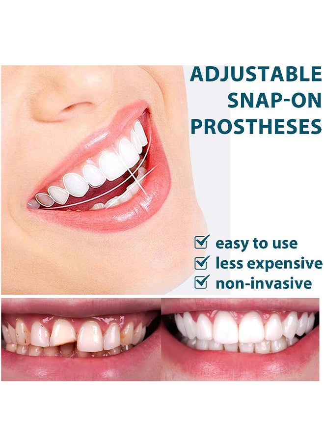 Adjustable Snap-On Prosthese, Cosmetic Denture Veneers For Upper And Lower Jaw, Denture Smile Teeth Customizable Temporary Perfect Fake Teeth Molds Braces For Snap In Instant And Confidence Smile