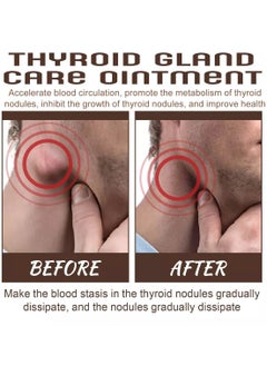 SOUTH MOON Thyroid Gland Care Cream Cream And Caused By Goiter 20g  - Image 3