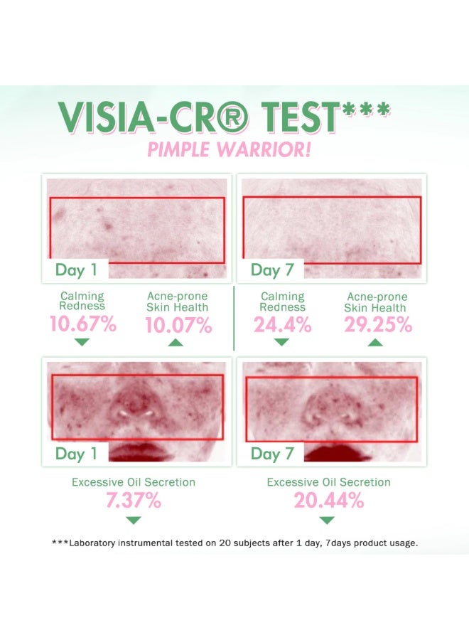 بي ان بي مجموعة بارين بليس المزدوجة والثلاثية المفعول من بي إن بي - لوشن لتجفيف حب الشباب ومحارب البثور ١٥ غرامًا - لوشن لتقليص حب الشباب [مجموعة من ٣ قطع] - Image 5