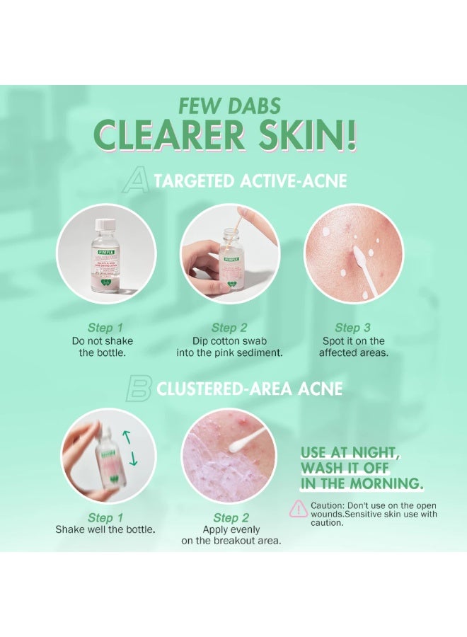 بي ان بي مجموعة بارين بليس المزدوجة والثلاثية المفعول من بي إن بي - لوشن لتجفيف حب الشباب ومحارب البثور ١٥ غرامًا - لوشن لتقليص حب الشباب [مجموعة من ٣ قطع] - Image 4