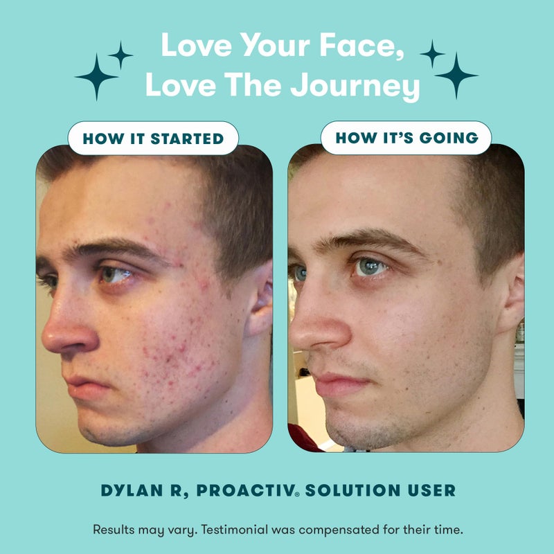 Proactiv 3 Step Acne Treatment - Benzoyl Peroxide Face Wash, Repairing Acne Spot Treatment for Face And Body, Exfoliating Toner - 60 Day Complete Acne Skin Care Kit - Image 5