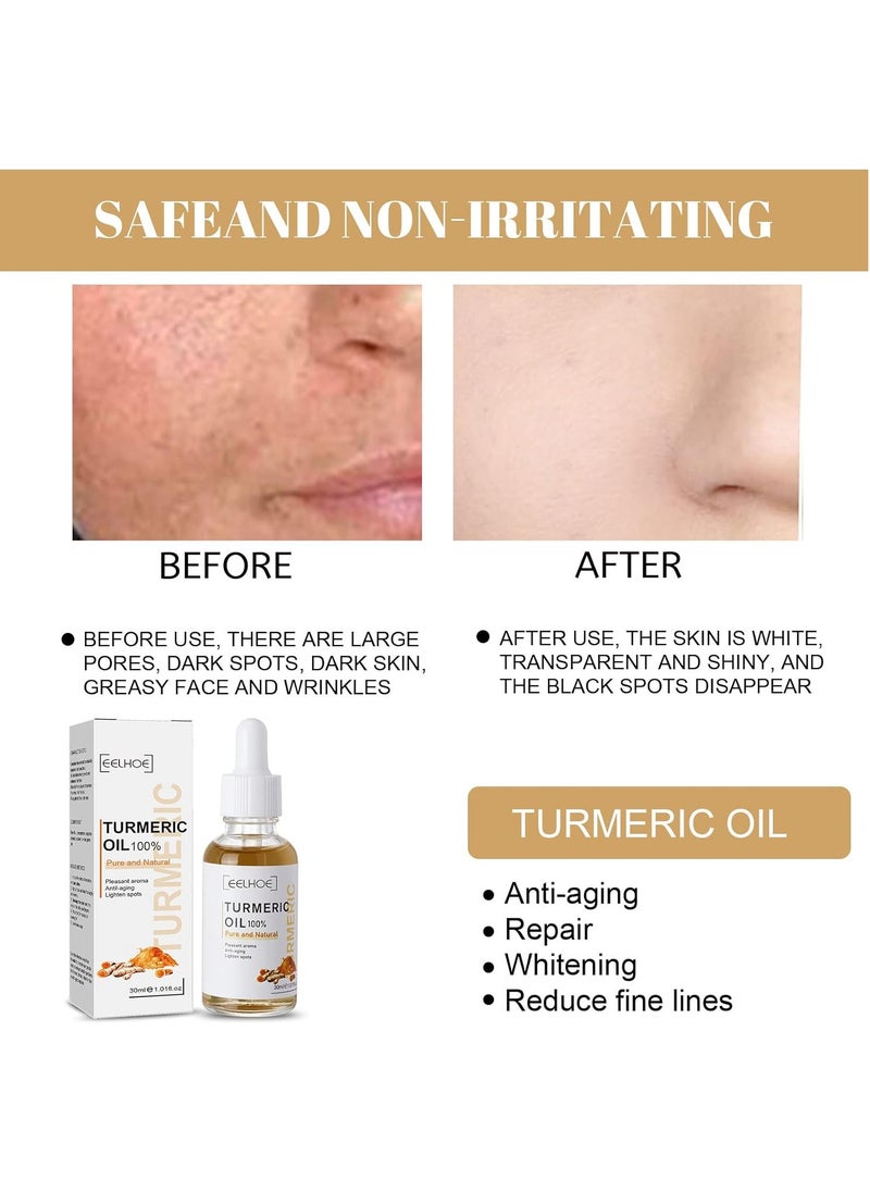 EELHOE Turmeric Dark Spot Corrector Serum Acne melasma Remover Face Turmeric Cream  - Image 3