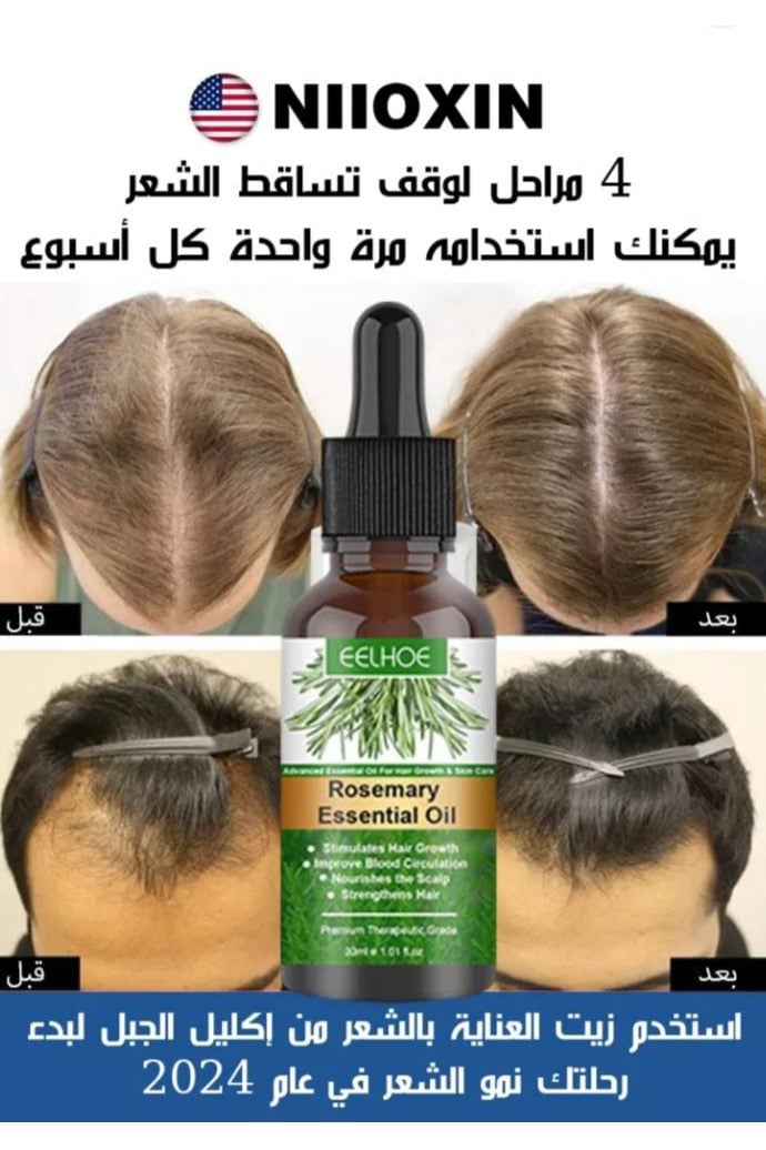 إيلهو زيوت إكليل الجبل العطرية ، زيت إكليل الجبل النقي لنمو الشعر والعناية بالبشرة ، وتغذية فروة الرأس ، ويحفز النمو