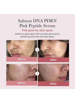 Medicube Pdrn Pink Peptide Serum, Pdrn (Sodium DNA) 1%, 5 Types Peptide Complex, Salmon DNA Pdrn Pink Peptide Serum, Pink Glow Serum for Dark Spots, 30 ml / 1.01 fl. oz.  - Image 2