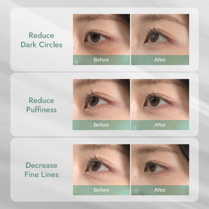 MIZON Cicaluronic Vegan De-puffing Eye Gel Patch, 24K Gold & Cica Under Eye Mask, Reduces Puffy Eyes, Dark Circles and Wrinkles (21 pairs) Stocking Stuffers - Image 3