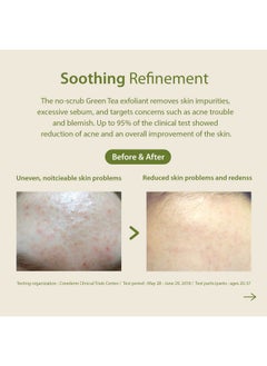 Blithe Patting Splash Mask Soothing & Healing Green Tea Lactic Acid Face Exfoliator Wash For Sensitive Skin Vegan K Beauty Oil Controlling & Pore Clarifying 2.3 Fl Oz  - Image 4